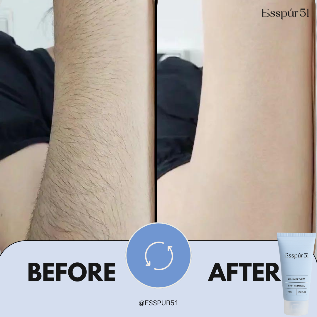SET B - Hair Removal Cream x2 + Free Aloe Vera x1
